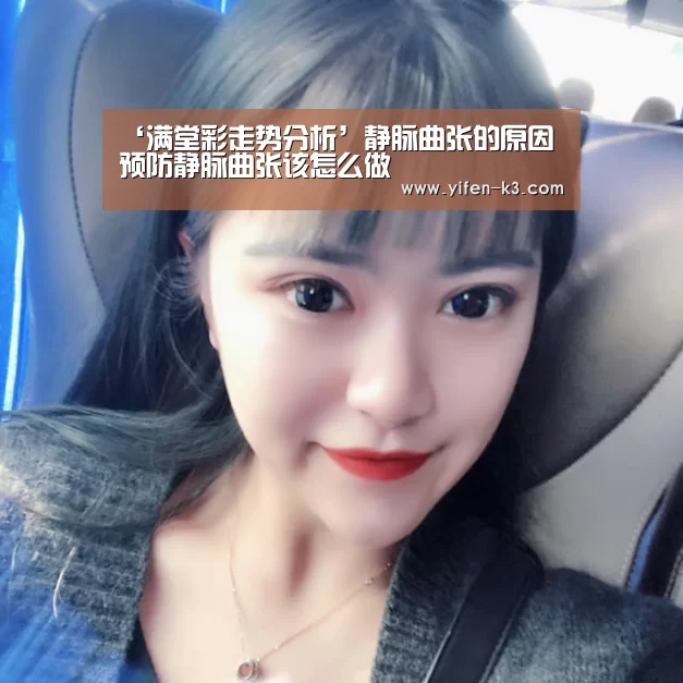 ‘满堂彩走势分析’静脉曲张的原因预防静脉曲张该怎么做(图1) 满堂彩走势分析