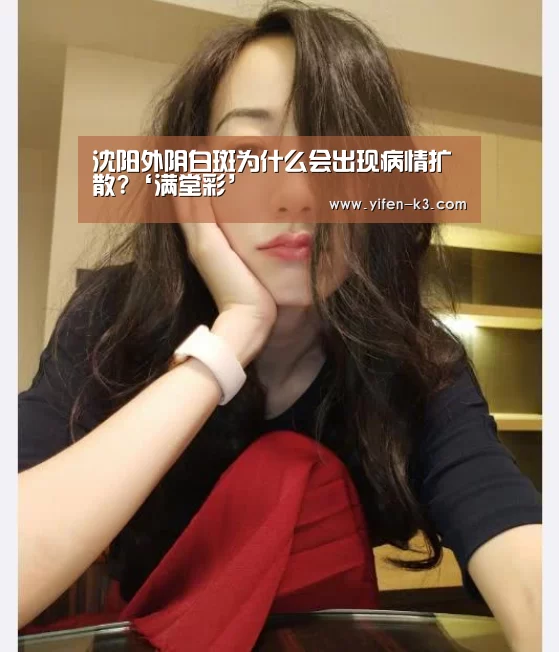 沈阳外阴白斑为什么会出现病情扩散?‘满堂彩’(图3) 满堂彩开奖查询